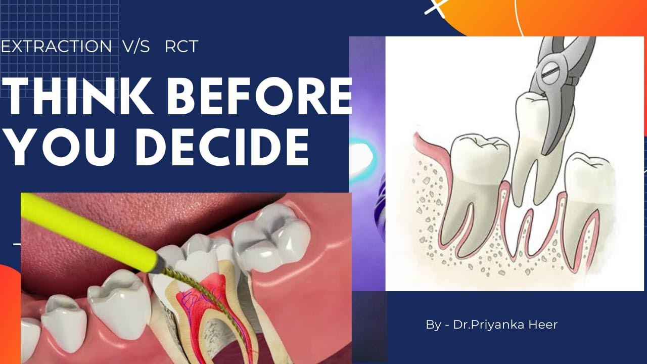 Extraction vs Root canal Treatment (RCT) Dr. Priyanka YouTube