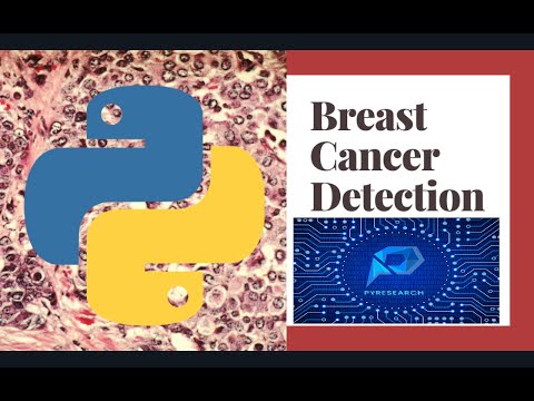 Breast Cancer Prediction