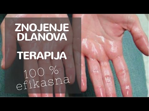 Video: Hiperhidroza - Zdravljenje Hiperhidroze Z Ljudskimi Zdravili In Metodami