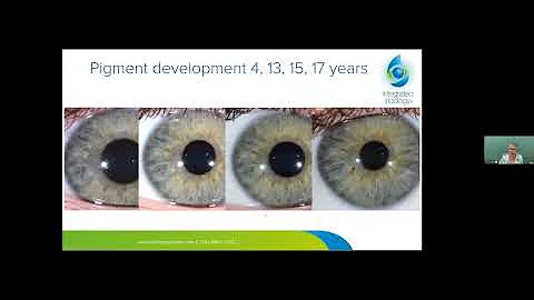 Integrated Iridology with Toni Miller