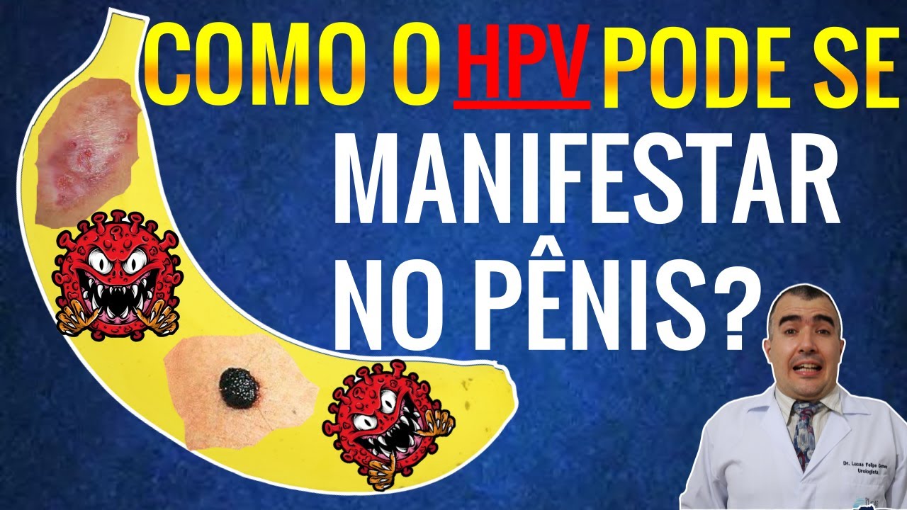 De Manchas escuras ao Câncer: Como o HPV pode se manifestar no Pênis ...