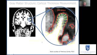 Middle and Older Adulthood in Autism: Brain and Behavioral Outcomes