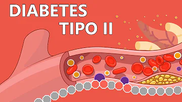 O que fazer para baixar diabetes tipo 2?