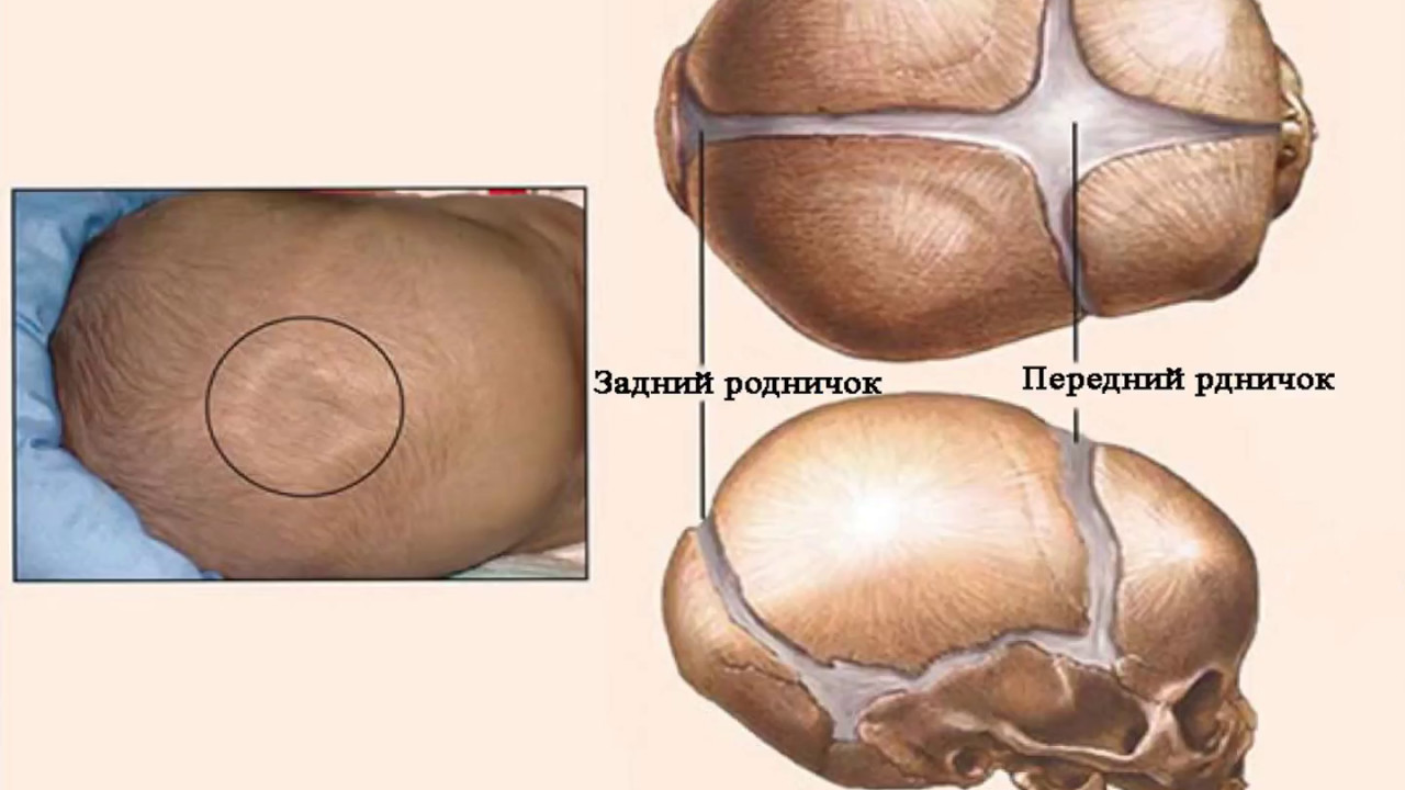 Череп новорожденного ребенка с родничками