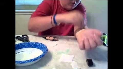 3rd degree Burn Tutorial