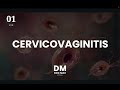 CERVICOVAGINITIS - ENARM