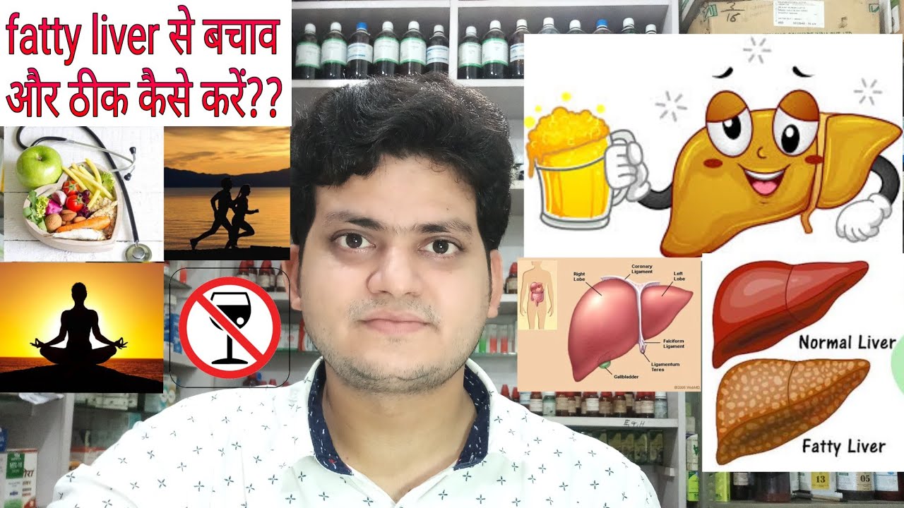 Fatty liver! Prevention from fatty liver and how to treat fatty liver