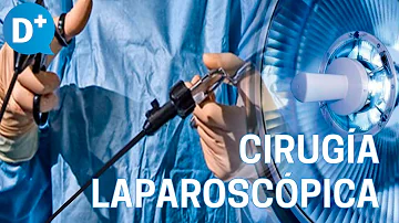 ¿Cuál es la cirugía laparoscópica más frecuente?