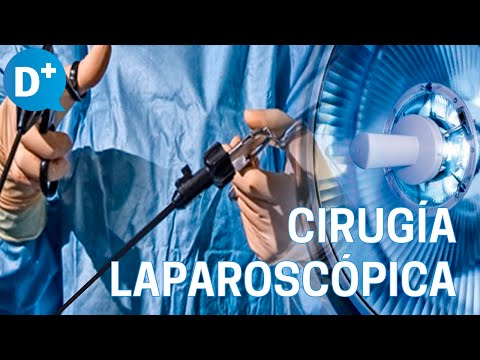 Vídeo: Laparoscopia De Las Trompas De Falopio: Tipos, Indicaciones Y Contraindicaciones