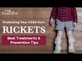 Rickets in children : Treatments and Prevention
