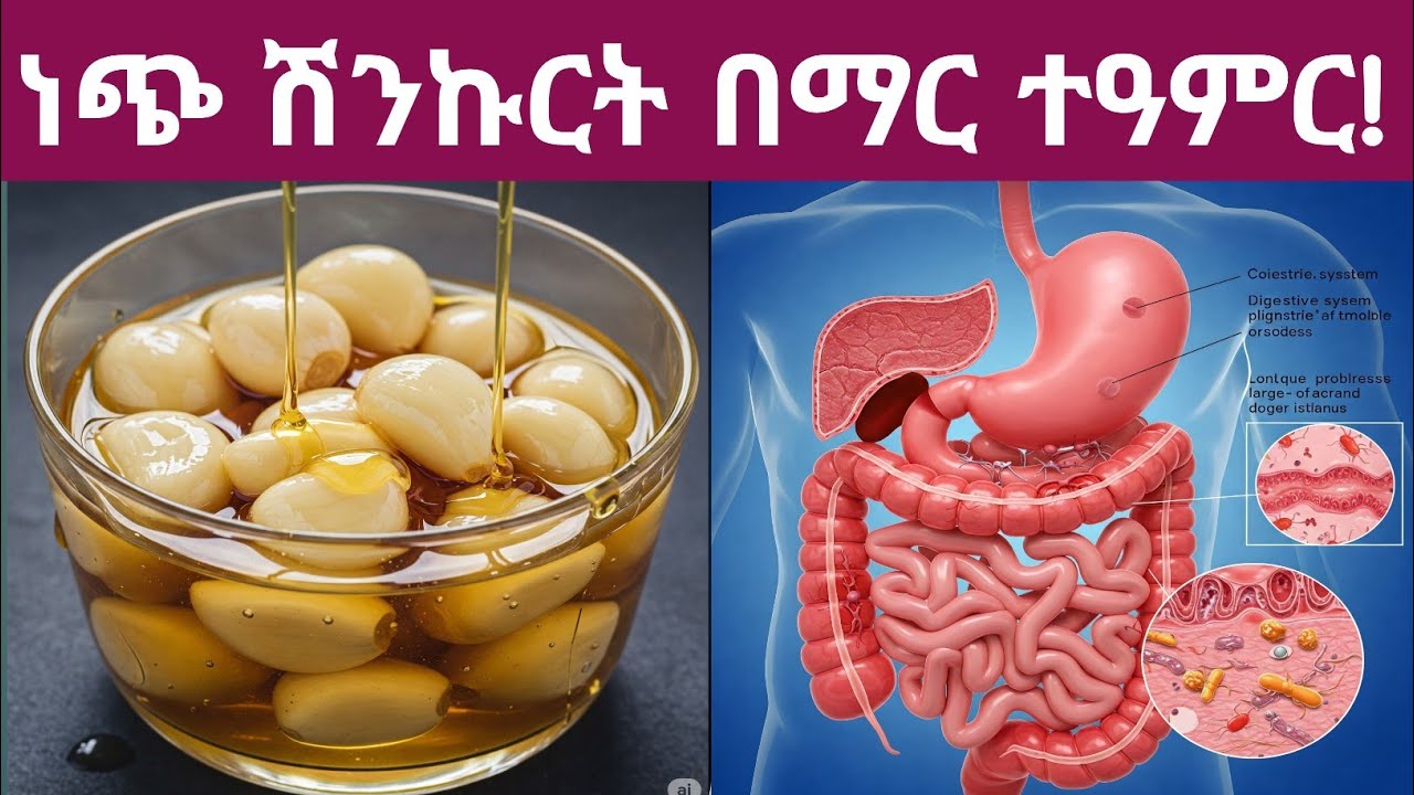 ነጭ ሽንኩርት በማር የሚሰጣችሁ ተዓምራዊ የጤና ጥቅሞች እና መጠቀም የሌለባቸው ሰዎች| Health benefits of Eating garlic with honey