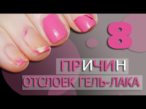 Причины отслойки гель лака/ 8 причин отслоек гель лака