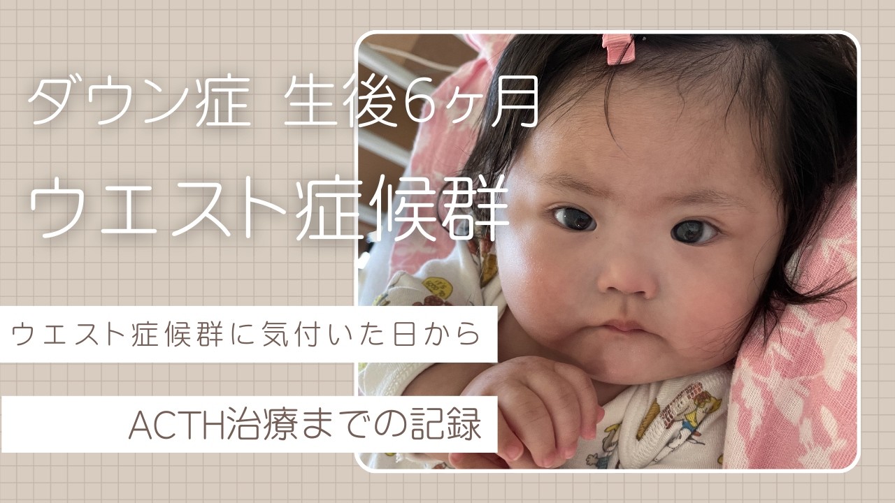ウエスト症候群の発作動画【ダウン症0歳６ヶ月】
