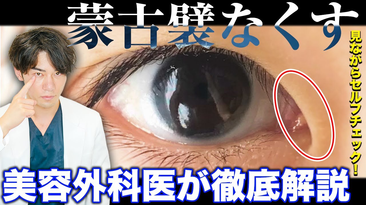 蒙古 襞 なくす