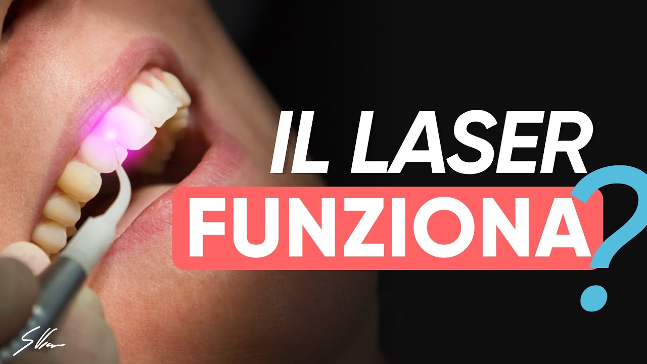 Gengive che sanguinano: il laser è davvero efficace?