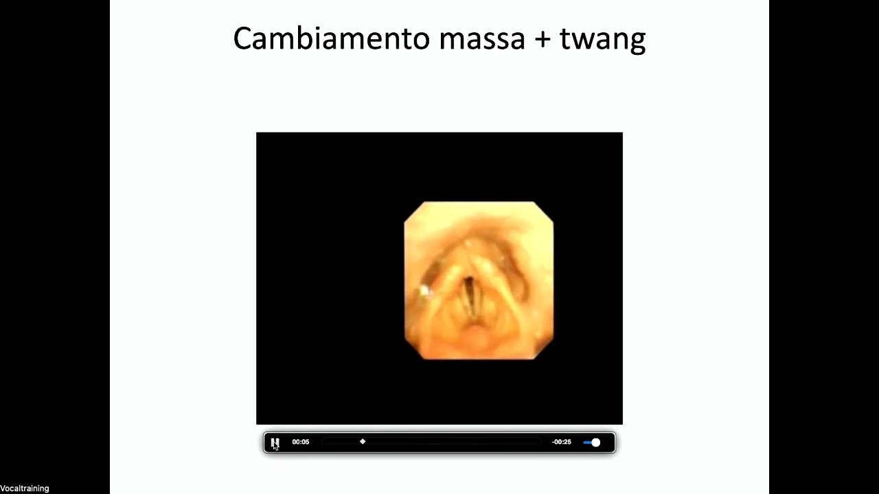 Il passaggio tecnica vocale