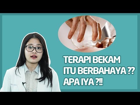 DIKLAIM BISA SEMBUHKAN STROKE, APAKAH TERAPI BEKAM AMAN UNTUK TUBUH?