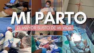 🚨La historia de MI PARTO 🚒 Cesarea de Emergencia CON FOTOS Y VIDEOS