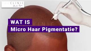 micro haar pigmentatie Amsterdam