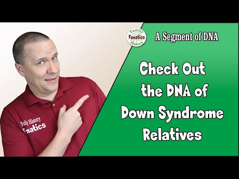 A Chromosome Look at Trisomy (Down Syndrome) - | Genetics Explained