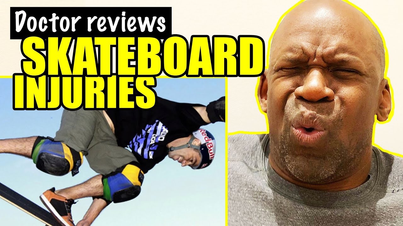 SKATEBOARDING INJURIES DOCTOR REVIEWS SKATEBOARD FAILS WITH BROKEN