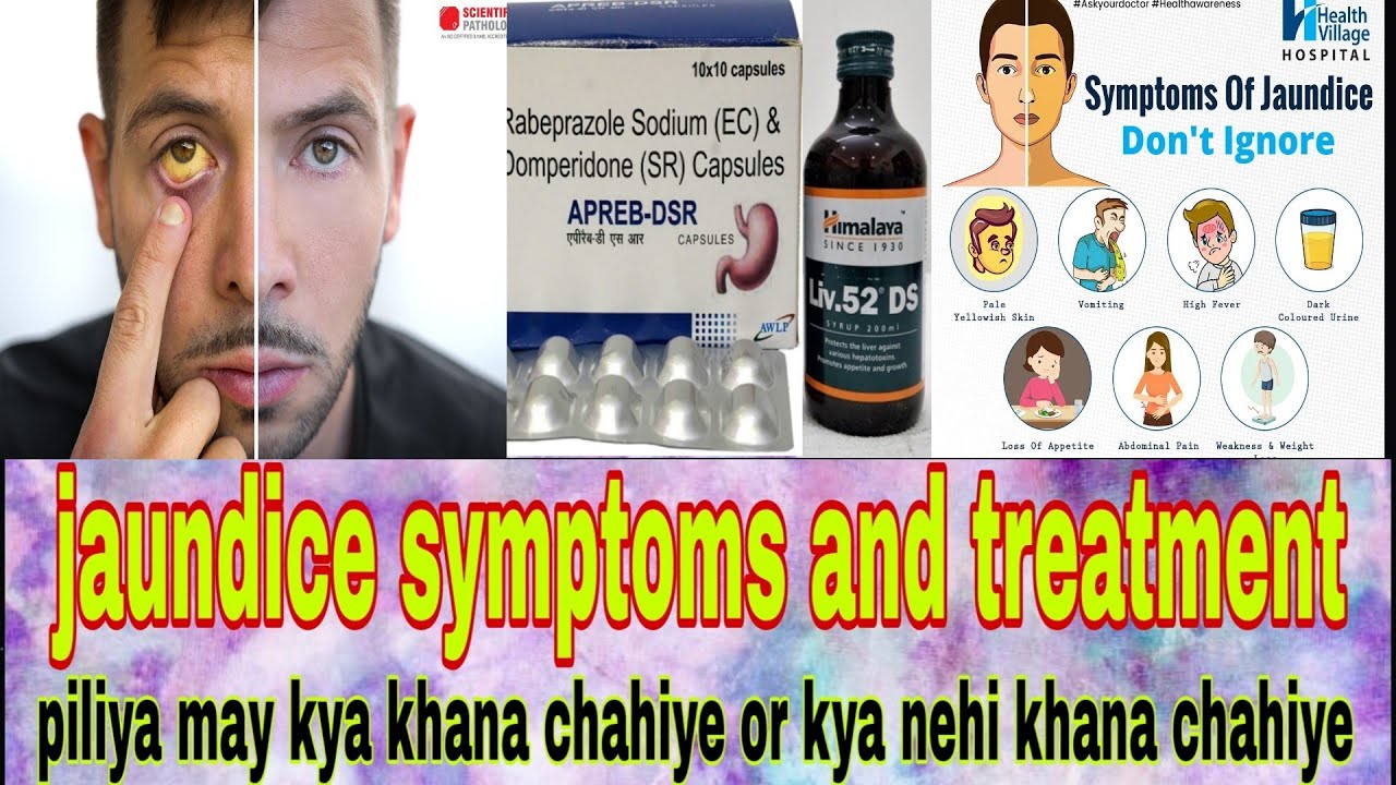jaundice symptoms and treatment piliya ka ilaj jaundice treatment