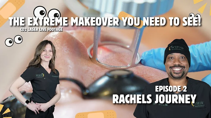 The Extreme Makeover You Need to See! - Episode 2 of Rachels Journey - DayDayNews