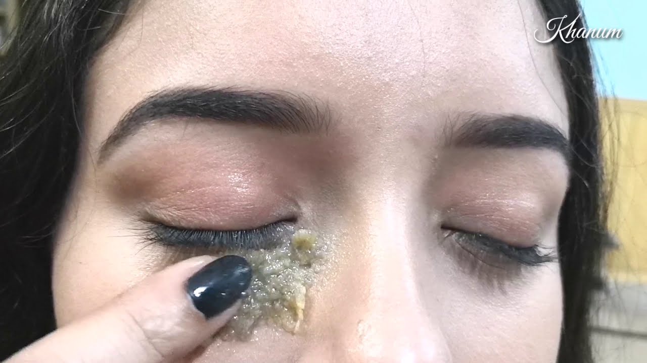 Get Rid of Dark Circles & Eye Wrinkles (جھریاں) Completely & Get Fair