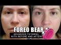 FOREO BEAR | BEFORE & AFTERS, ADVANCED TUTORIAL AND TIPS TO GET THE BEST RESULTS