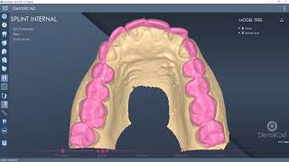 DentalCad 7.2 - Tutorial Splint