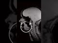 Así se ve la Radiografia de Mujer Cantando #short