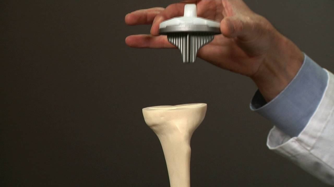 Model of a Shin Bone (Tibia)