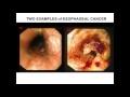 Why The Esophageal Health Of A Masai Tribesman In Kenya Matters To GI Docs In The US Why The Esophageal Health Of A Masai Tribesman In Kenya Matters To GI Docs In The US