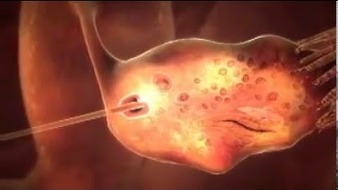3d animation of how ivf works