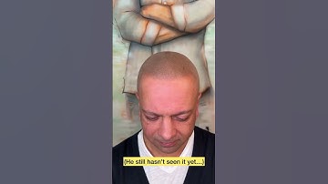 Scalp micropigmentation reaction #scalpmicropigmentation #barber