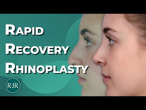Video thumbnail: Rapid Recovery Rhinoplasty- Dr. Rod Rohrich