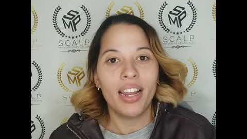 Scalp Micropigmentation Testimony