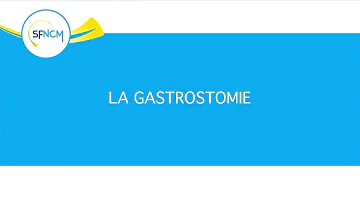 Comment faire une gastrostomie ?