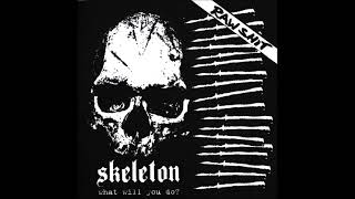Skeleton - What Will You Do? 7" EP 2005 (Full Album)