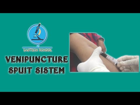 Video: Cara Mengatasi Masalah Venipuncture yang Sulit: 14 Langkah