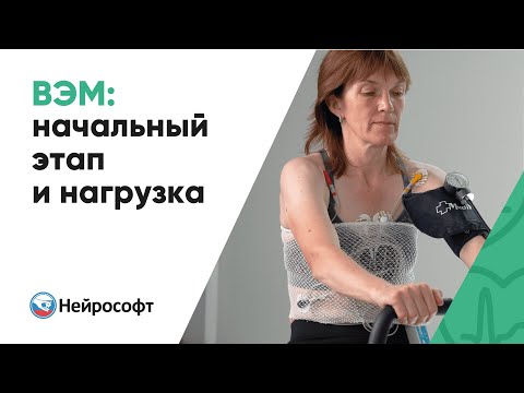 Велоэргометрия: начальный этап и нагрузка