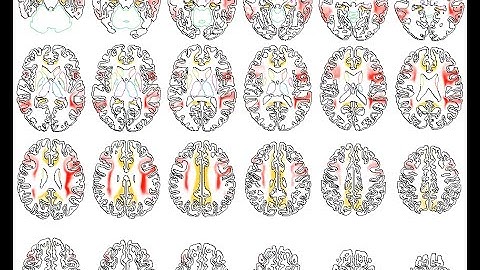 Visualizing brain regions using slice-wise line art