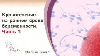 видео Выделения на ранних сроках беременности. Ранний срок беременности: кровянистые выделения, причины