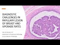 Diagnostic challenges in papillary lesion of breast and upgrade rates
