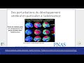 Ref:RdY18dwCoNQ [webinaire] stress et psychoses : j�r�me brunelin et fr�d�ric haesebaert