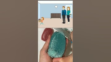 How OCD ruined the LIFE of a 3 Year old #shorts