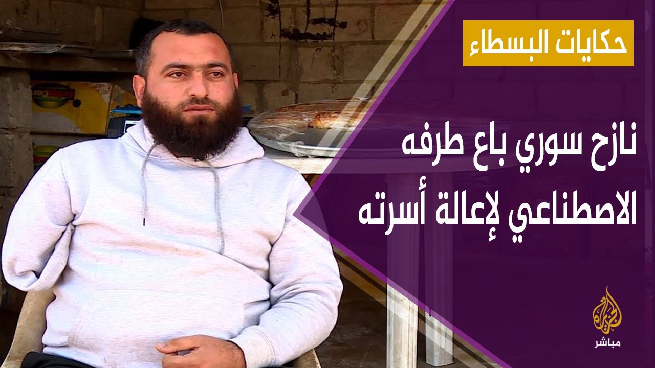 حكاية نازح سوري باع طرفه الاصطناعي ليفتتح محلاً يعيل به أسرته