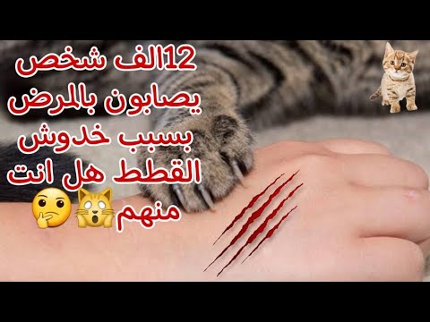 12الف شخص يصابون بالمرض بسبب خدوش القطط هل انت منهم