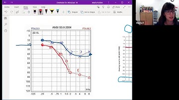 Understanding Audiology Reports