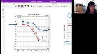 Understanding Audiology Reports